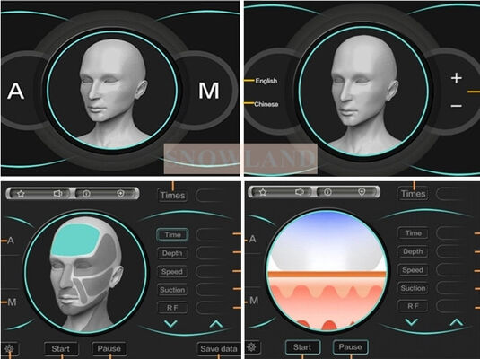 Полупроводниковый лазерный диод 808 нм для эпиляции с датчиком контакта с кожей, обеспечивающий быструю процедуру удаления волос