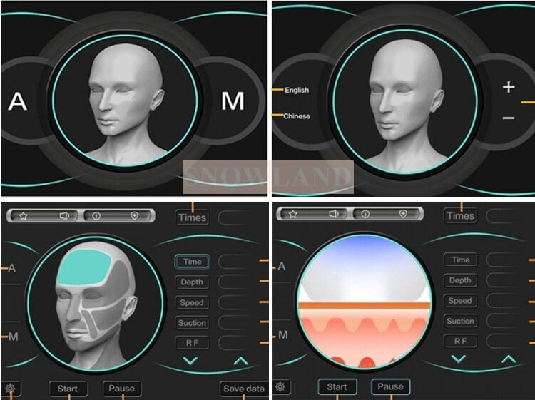Полупроводниковый лазерный диод 808 нм для эпиляции с датчиком контакта с кожей, обеспечивающий быструю процедуру удаления волос